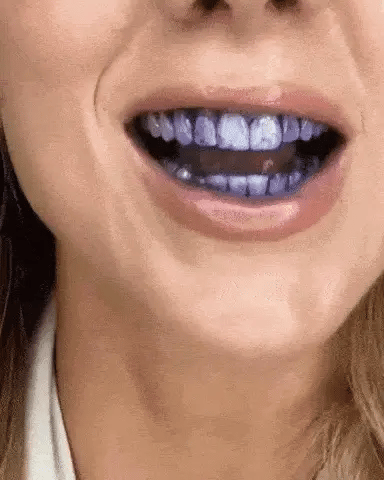 SMILEWHITE™ Toothpaste